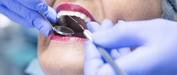 Best Emergency Wisdom Teeth Removal in Centreville, AL